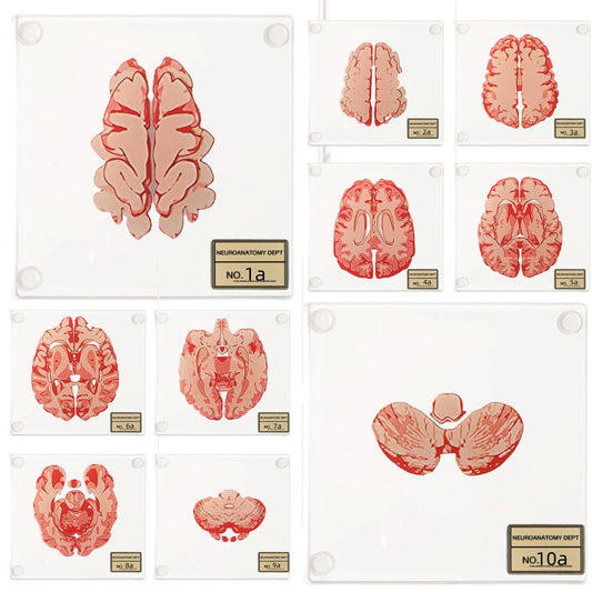 (10pieces) 3D Anatomic Brain Specimen Coasters-Acrylic Coasters-Neuroscience Gifts-Funny 3D Coasters Gifts-Medical Student Gifts- Brain Decor-Lab Coaster for Desk