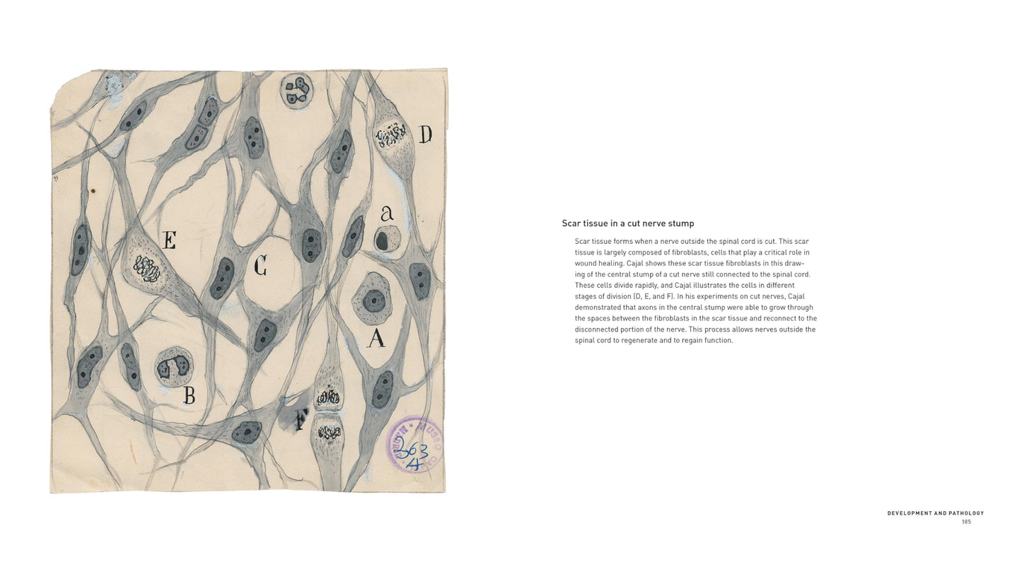The Beautiful Brain: The Drawings of Santiago Ramon y Cajal